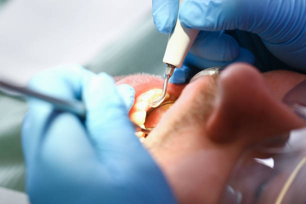 Best Chipped Tooth Repair Near Me  in Morristown, NJ