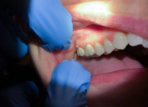 Best Urgent Tooth Repair  in Morristown, NJ