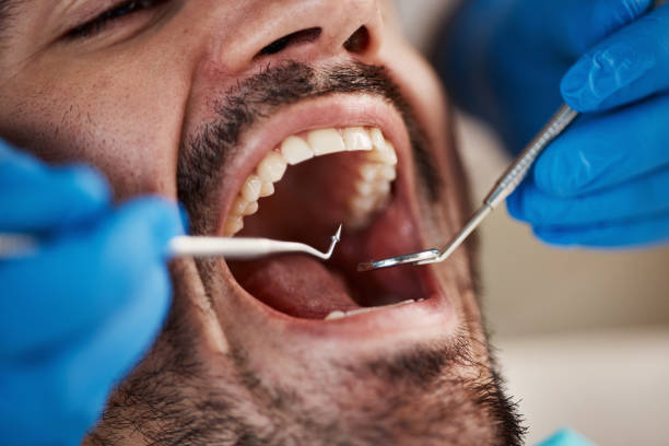 Best Broken Tooth Emergency  in Morristown, NJ