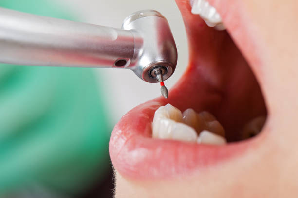 Tooth Infection Emergency Dentist in NJ